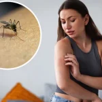 insektsbett-pa-sommaren-hur-man-skiljer-vad-man-ska-behandla.webp.webp